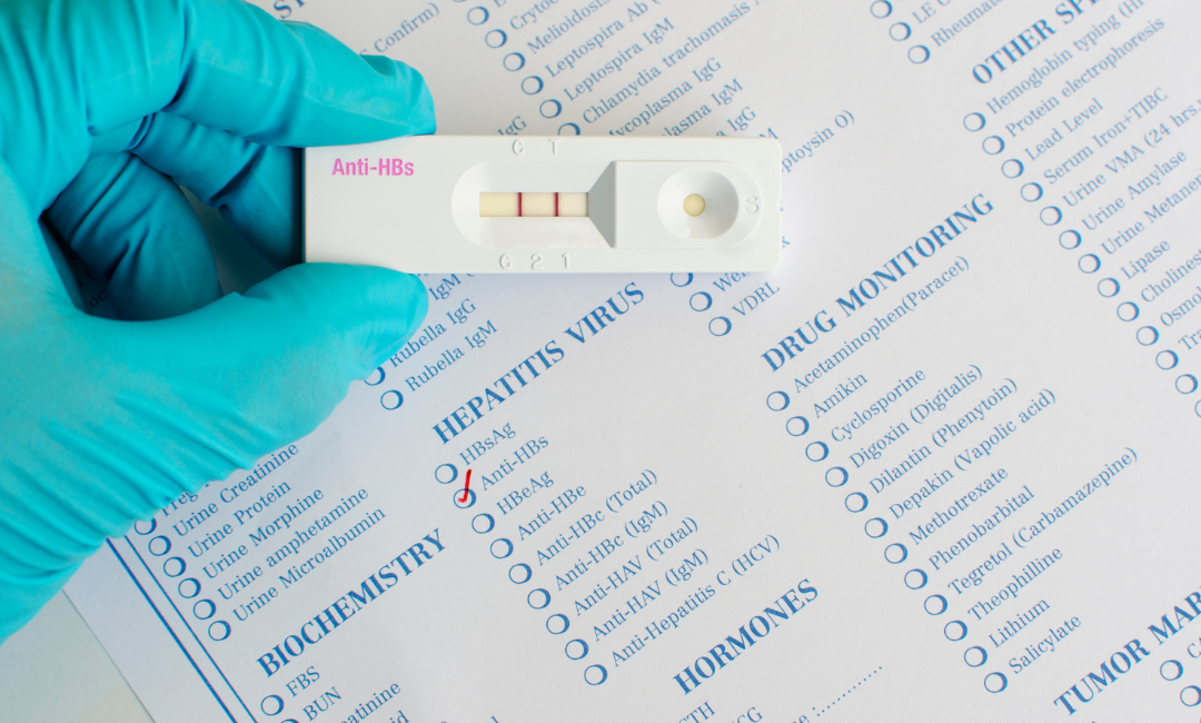 Anti Hbs