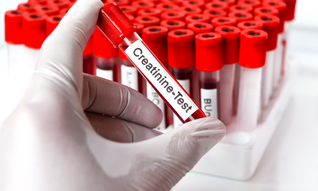 Kreatinin Değerlerini Etkileyen Durumlar