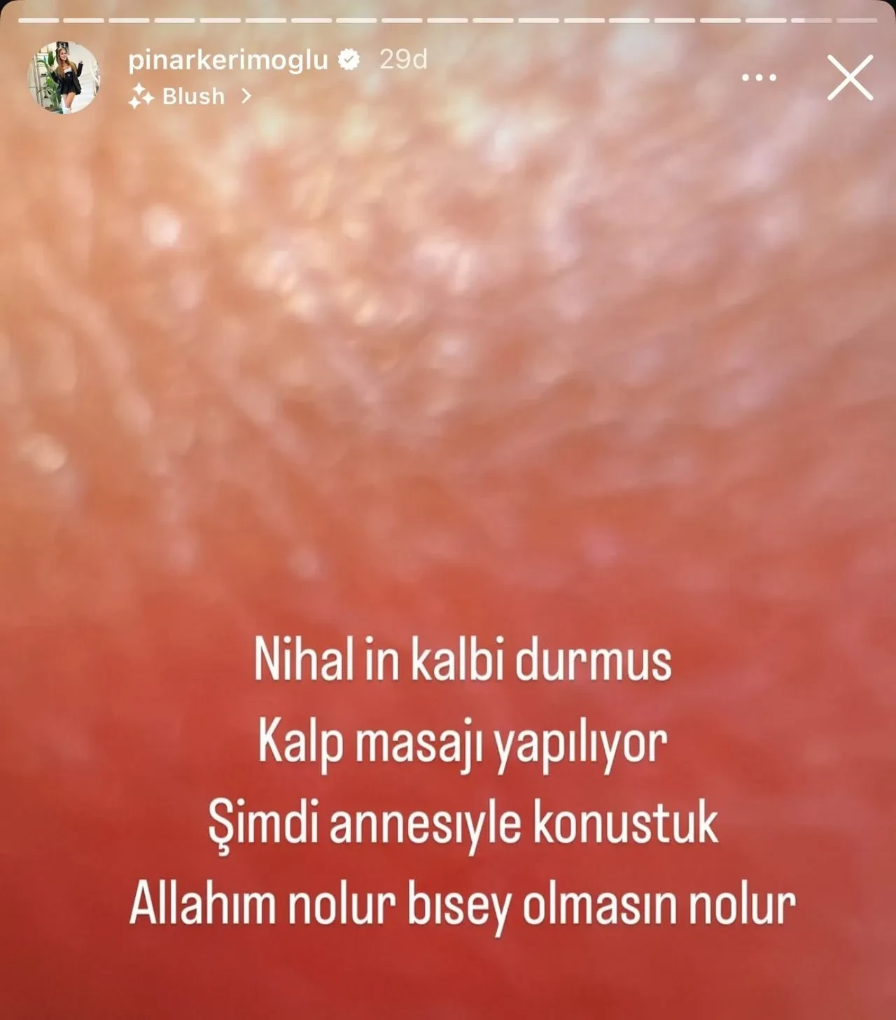Nihal Candanin Kalbi Durdu Saglik Durumu Kritik 3228293 202506191913 1 2