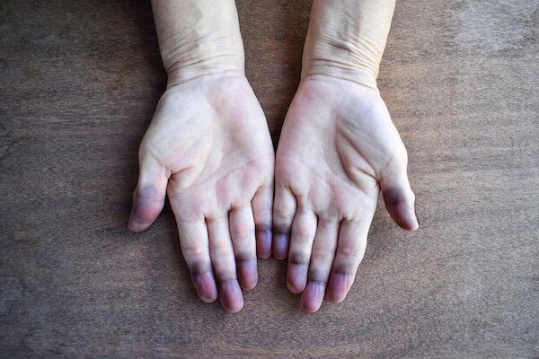 8Lwovmhhq Shutterstock 1854071839