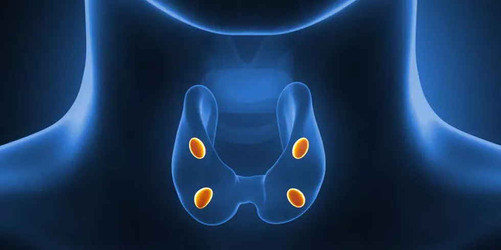 Ameliyatsiz Paratiroid Adenomu Tedavisi Etanol Ablasyon 795G9