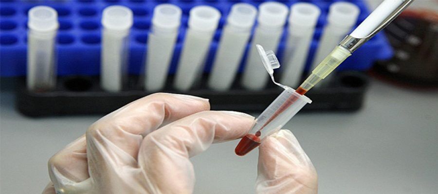Elisa Testi Nasıl Yapılır