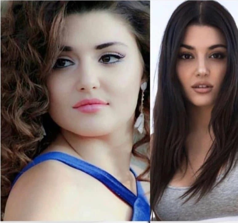 Hande Erçel Eski Hali