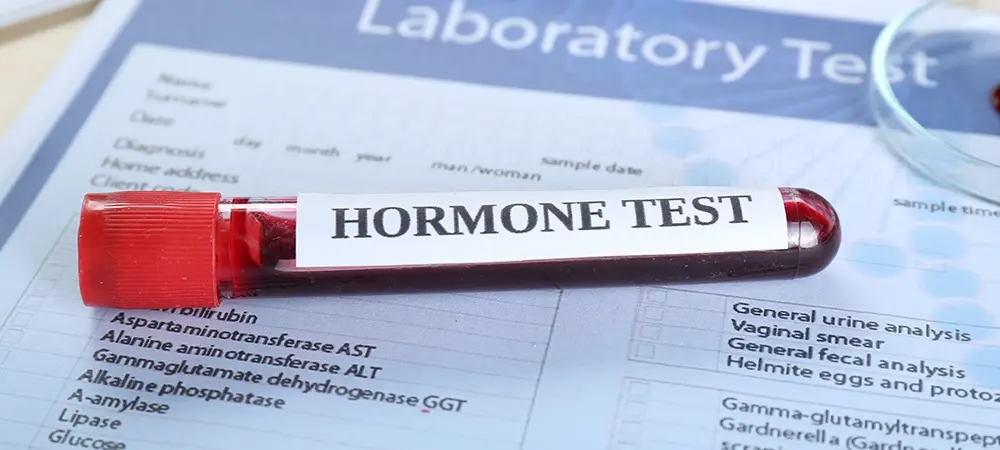 Hormon Testi