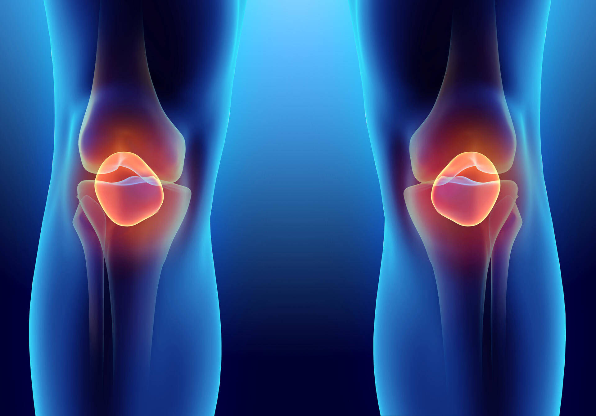 Meniscus Yirtigi
