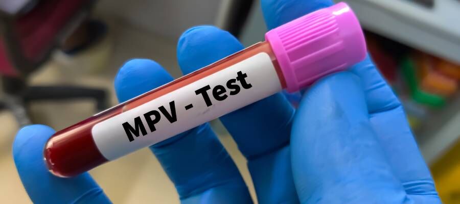 Mpv Düşüklüğü