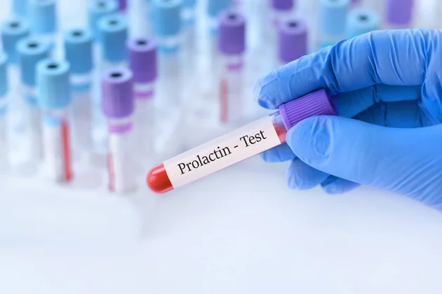 Prolaktin Nedir-1