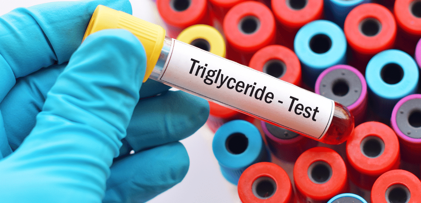 Tri̇gli̇seri̇d Testi