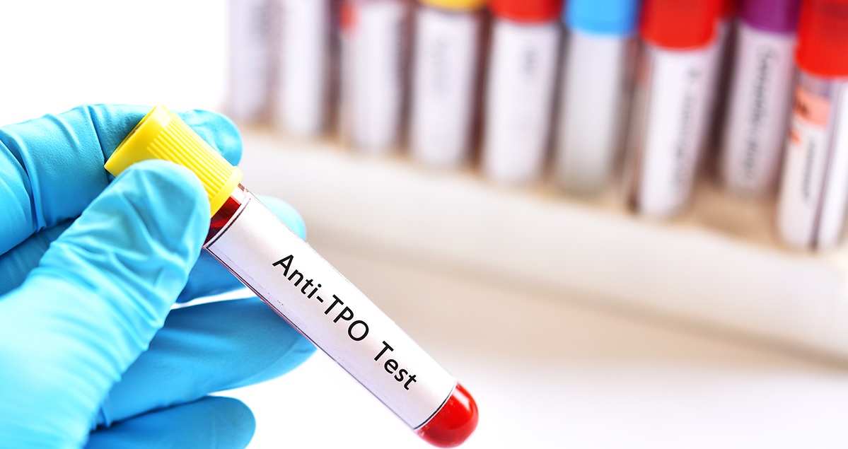 Anti Tpo Değeri Kaç Olmalı