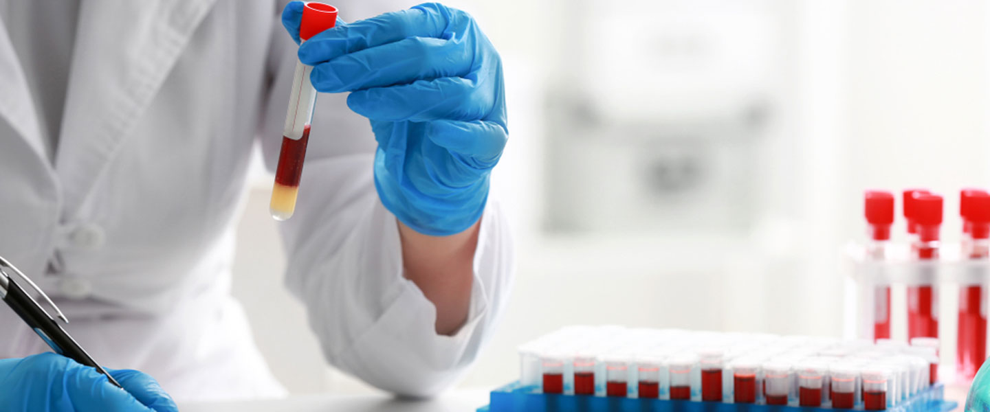 Bebeklerde Pct Yüksekliği