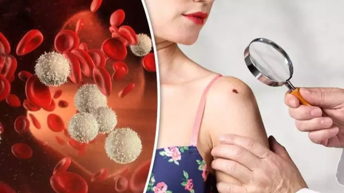 Beyaz Kan Eksikliği Belirtileri