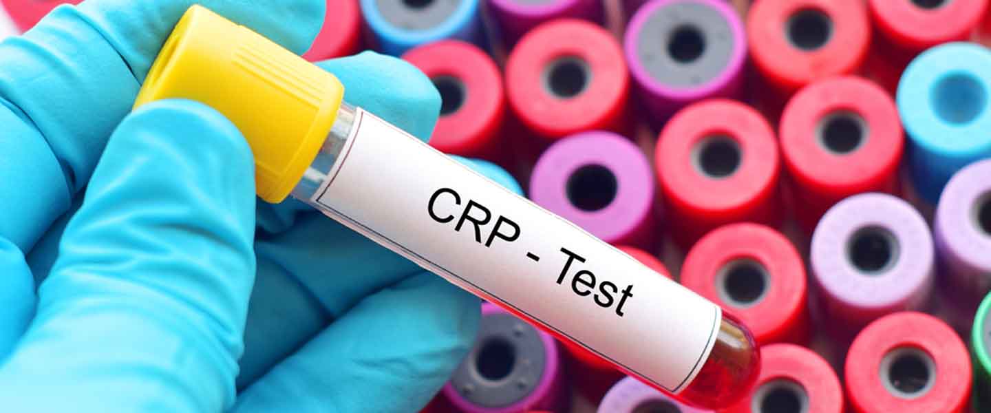 C Reaktif Protein Nedir 2