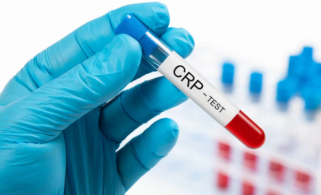 Crp Türbidimetrik Nedir