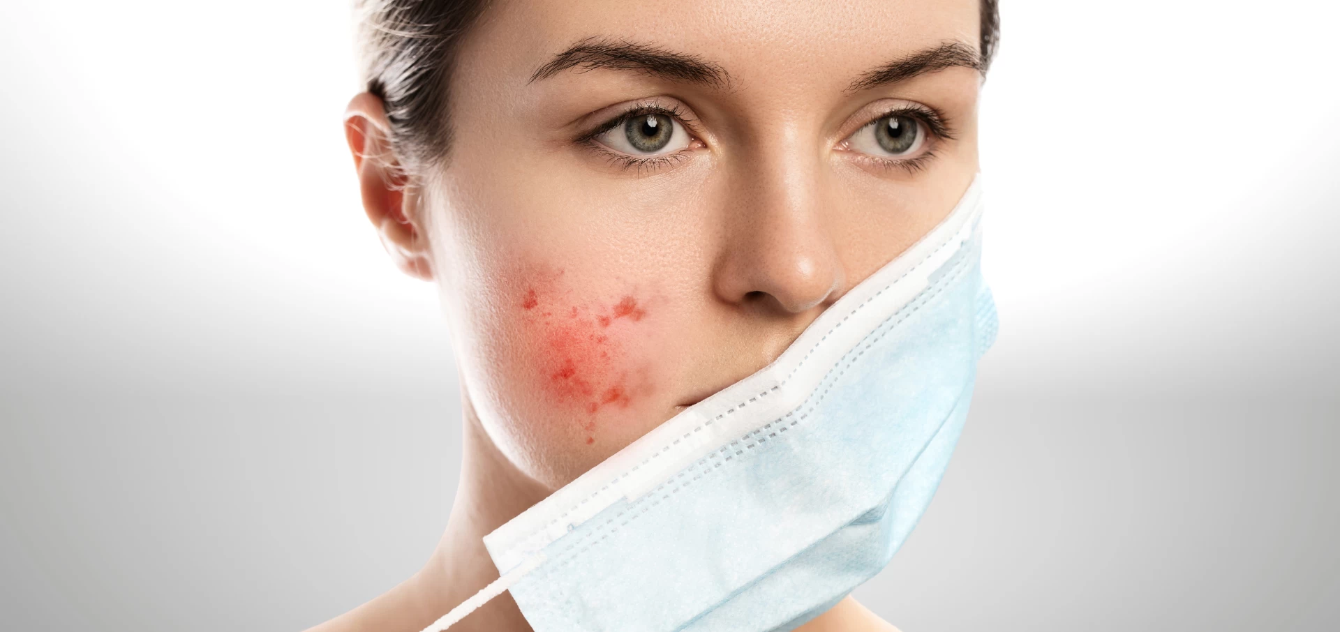 Gül Hastalığı Neden Olur