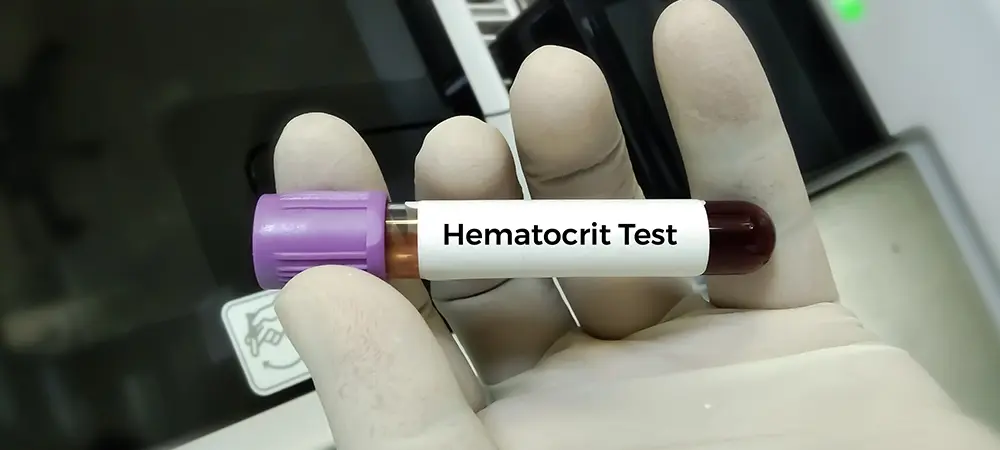 Hematokrit Nedir 4