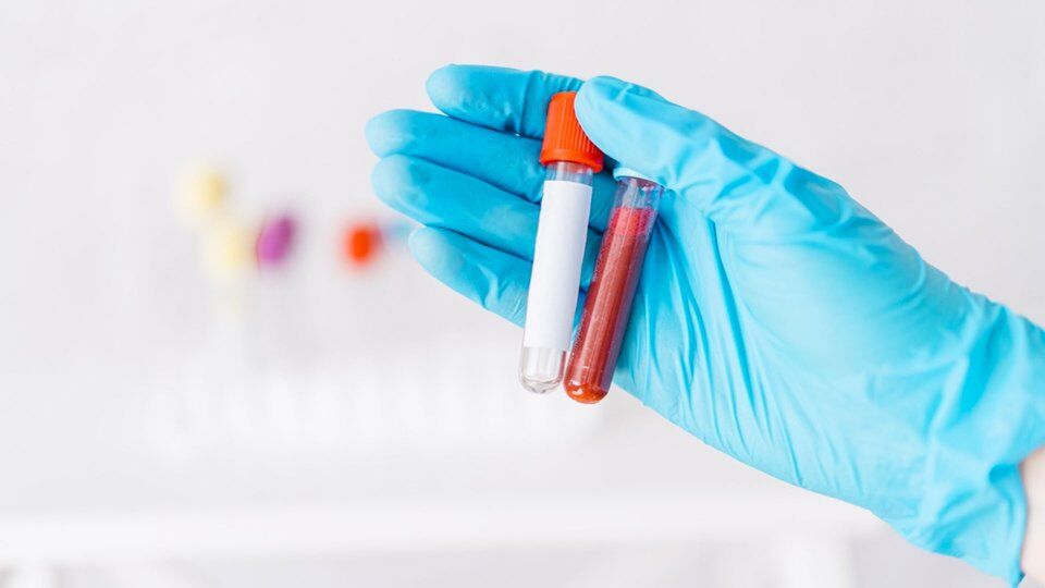 Hematokrit Nedir