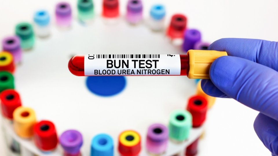 Kan Üre Azotu Nedir 2