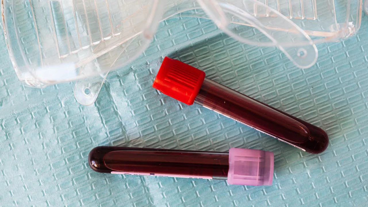 Lym Yüksekliği Nedir 4