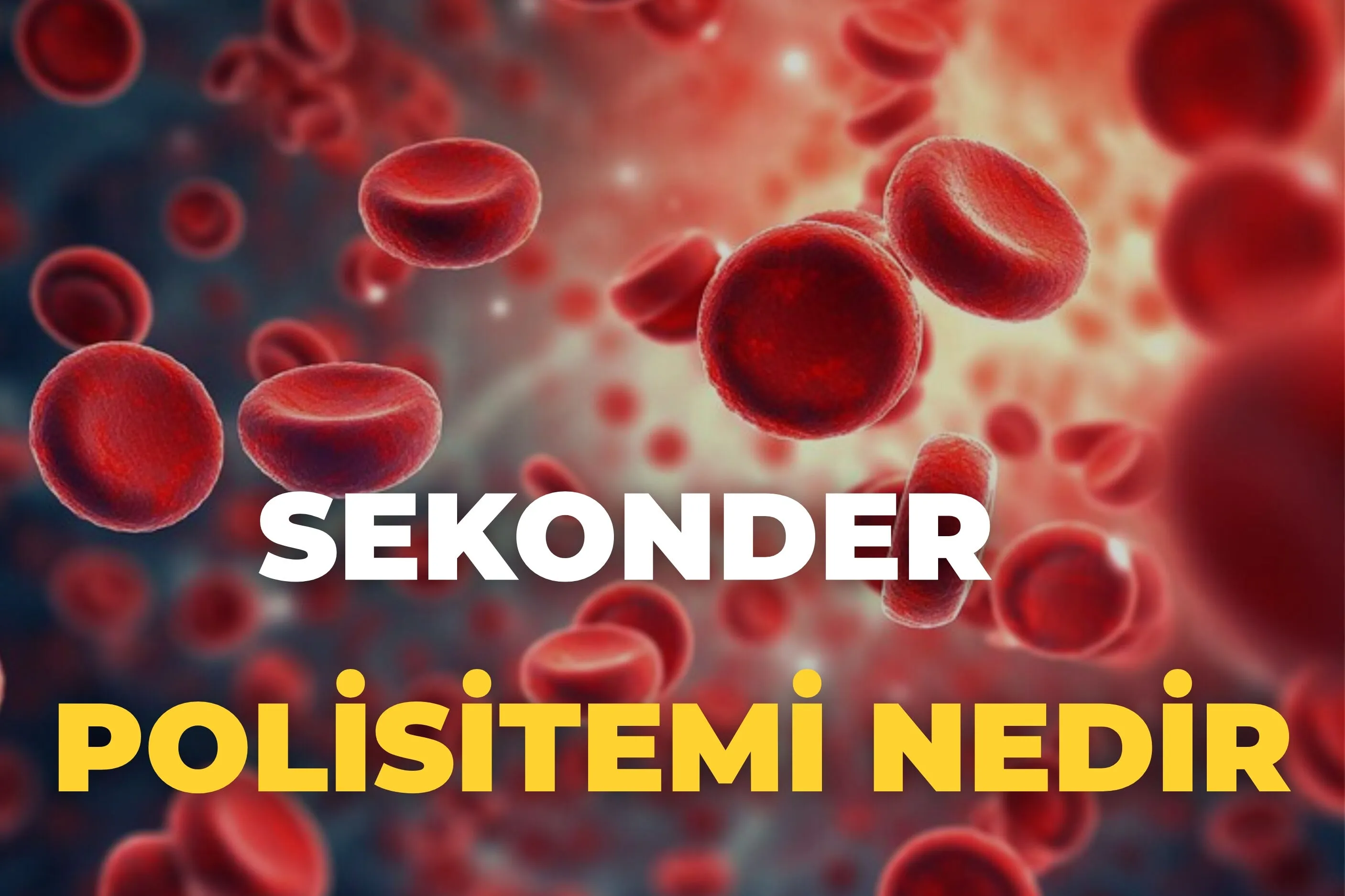 Polisitemi Nedir 5