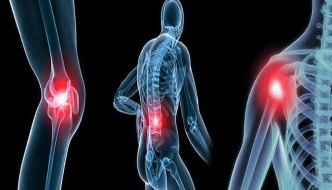 Romatizma Nedir Rontgen