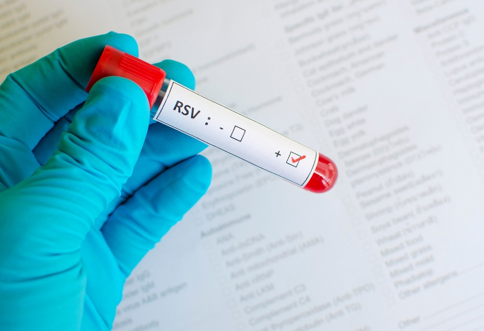 Rsv Nedir 4