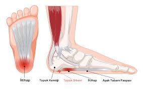 Topuk Dikeni Nedir