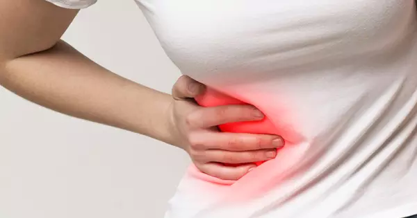 Apandisit Nedir