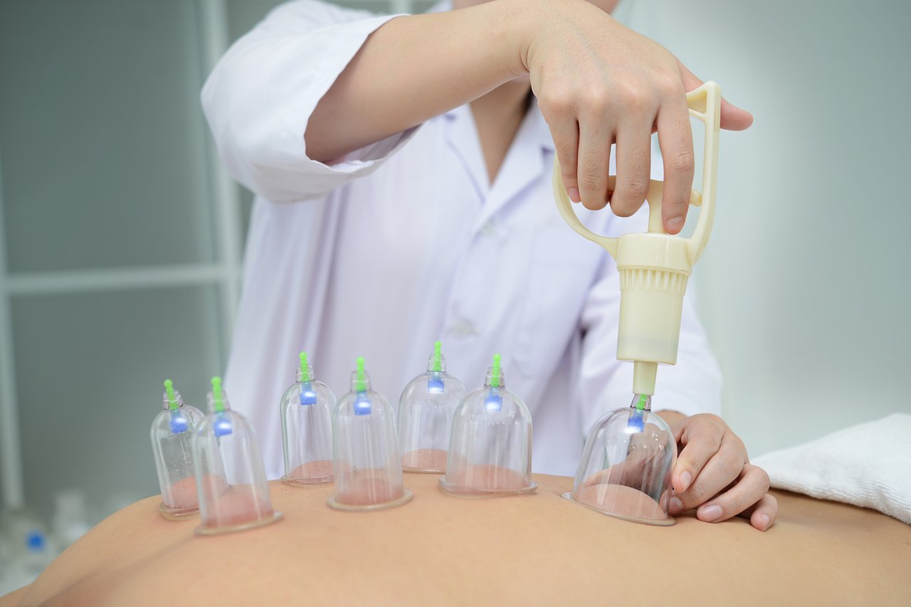 DSÖ Türkiye’yi kutladı: Hacamat ve sülük tedavisinde dünyaya örnek adım!