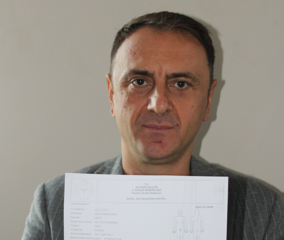 Kayseri Futbolcu Darp 2