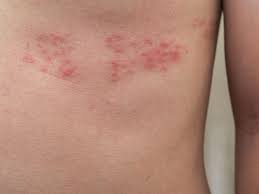 Indir 2025 11 05T150648.026