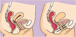 Indir 2025 11 06T170343.037