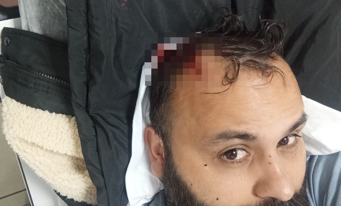 Kayseri Kukla Sanatçısı Darp 2