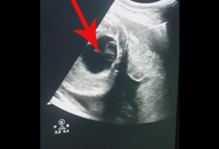 Thumbs B C B574882F65Fa95D7C497B9A234194E8B