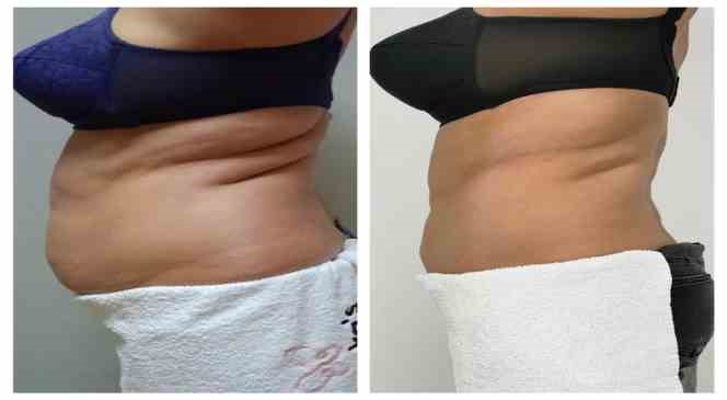 Ihacomtr D320361C E671 4252 9Ff0 696F4Decf59F-1