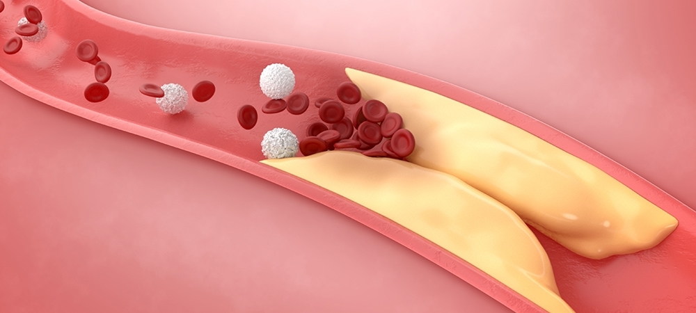 Kandaki Yagi Eriten Bitkiler 23 88587 Web Image T