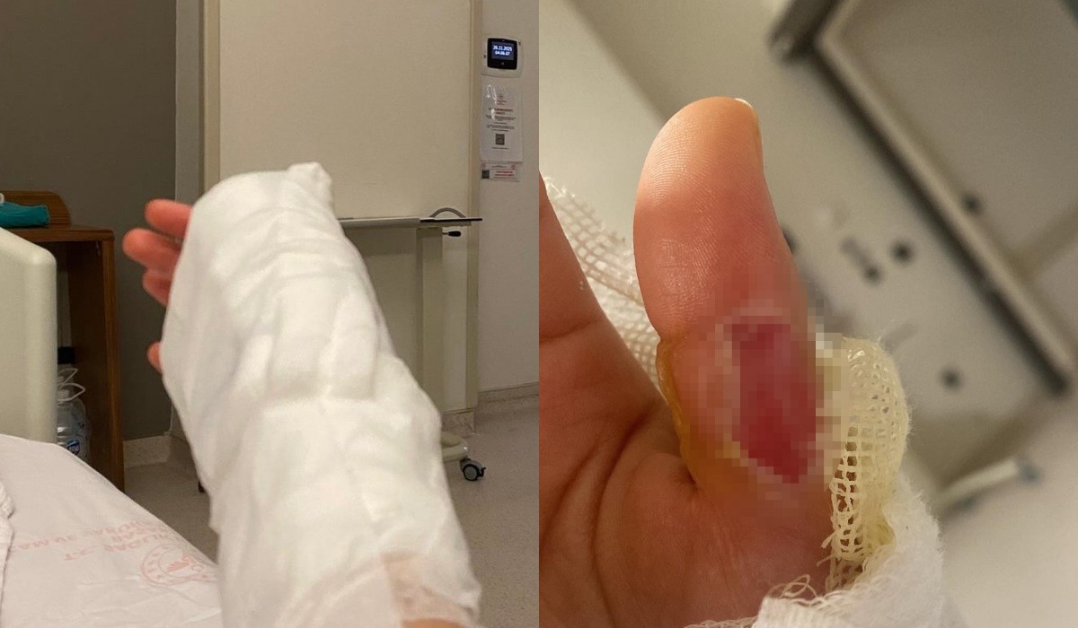 Sıcak Su Torbası Faciası! Genç Kızın Vücudunun Yüzde 25'I Yandı1