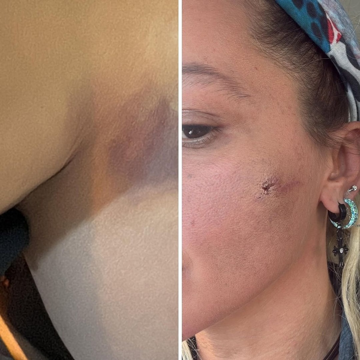 Yıldız Asyalı Darp