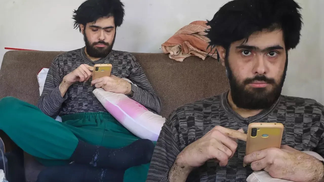 3 Yildir Tirnaklarini Kesmeyen Ve Dus Almayan