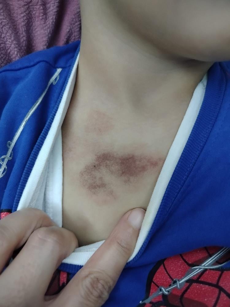 İbb Kreşinde Istismar Ve Darp Iddiası 2