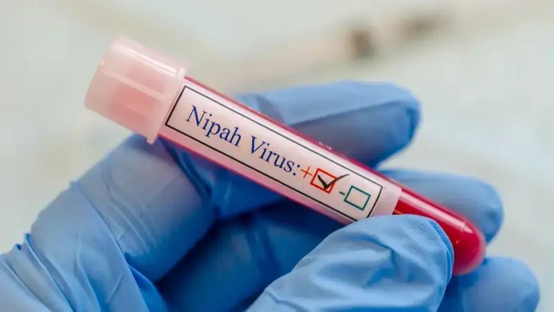 Nipah Virüsü Nedir