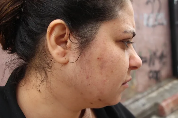 0X0 Adana Eski Esine Cocuklara Iyi Bak Deyince Cikan Tartismada Darbedildi 1770039372445