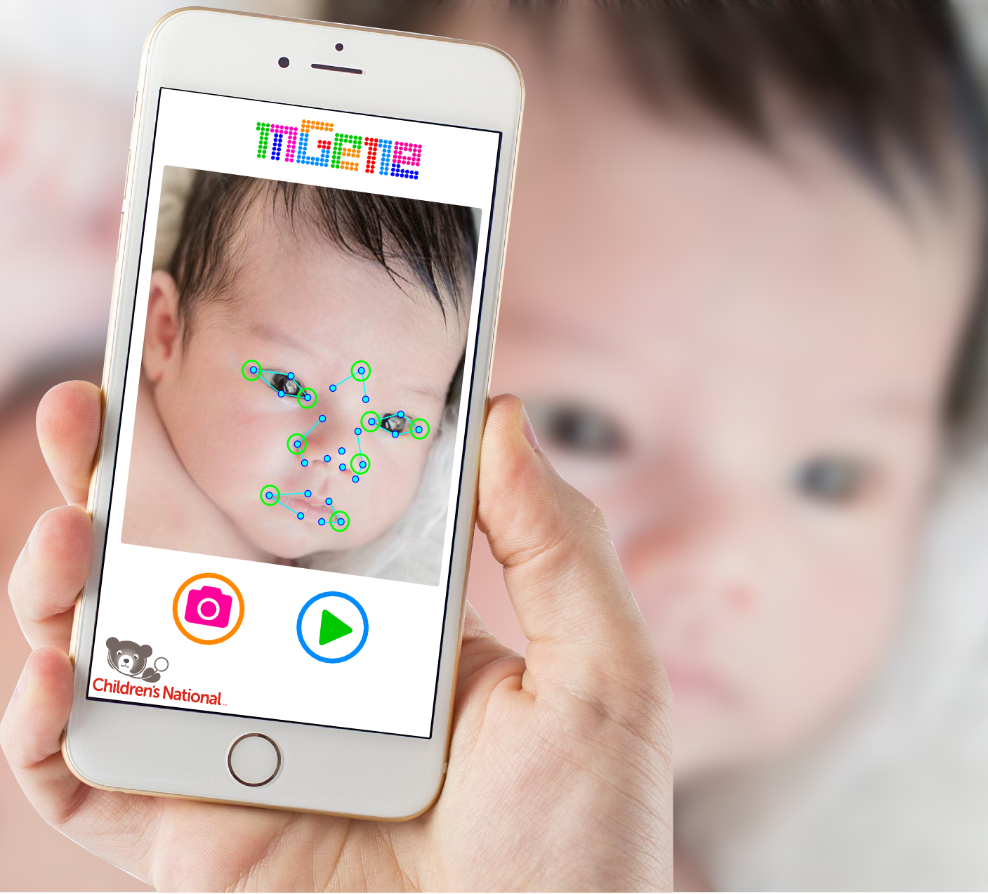 1770817366 Caption With A Smartphone M Gene S A I Technology Can Analyze Facial Features To Identify Subtle Indications Of Genetic Syndromes-1