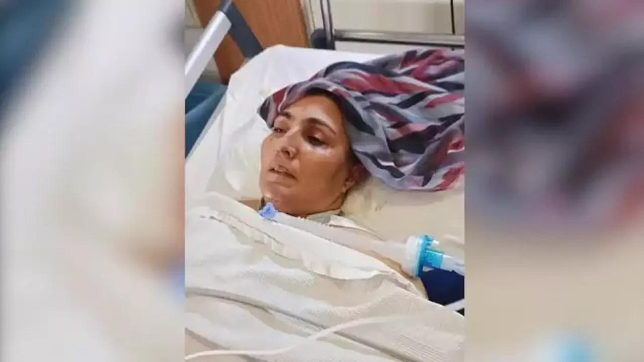 Esinin Dovup Olayi Kaza Gibi Gostermeye Calistigi Kadin 54 Gundur Yogun Bakimda 1770100869 4209