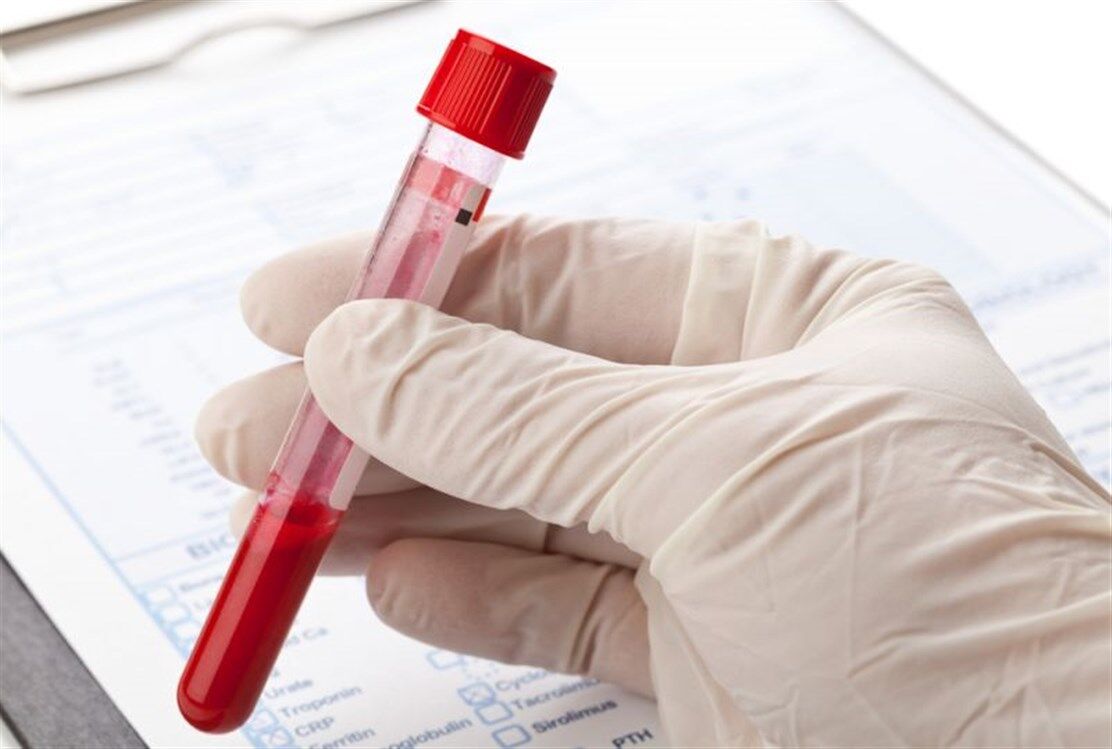 Estradiol Nedir