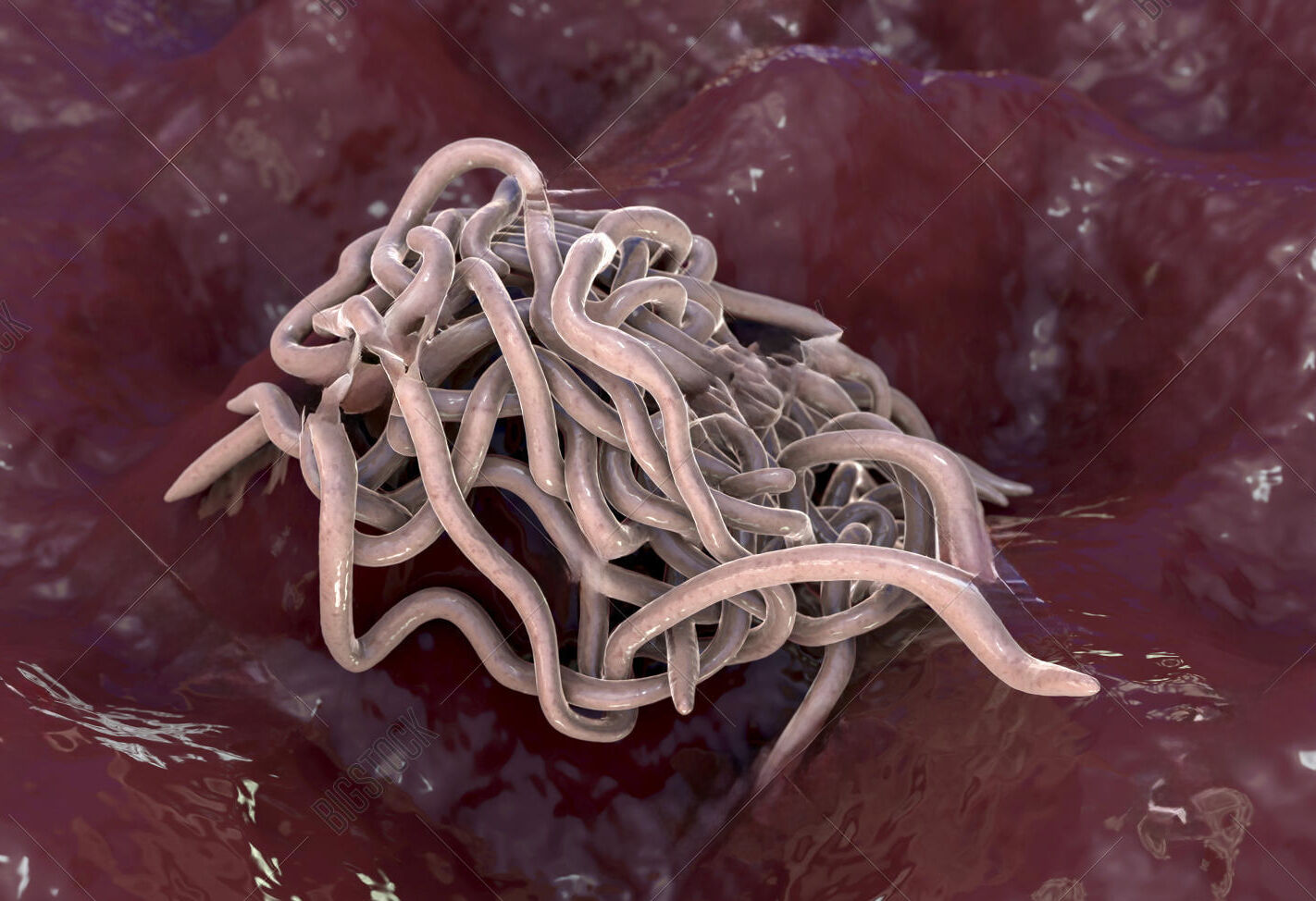 Kil Kurdu Dr Ayse Sibel Tugral Kocaeli Cocuk Doktoru 2