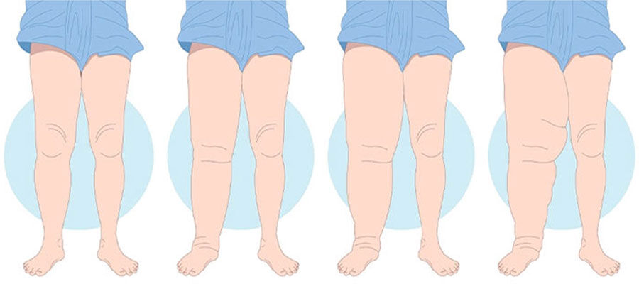 Lipodem 130820250931384101374