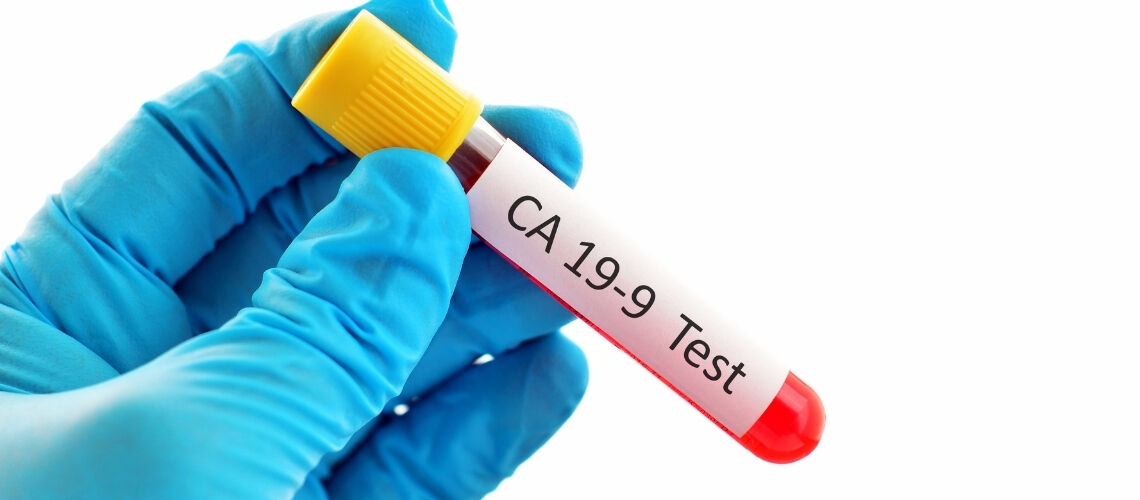 C A 19 9 Nedir C A 19 9 Yuksekligi Ne Anlama Gelir