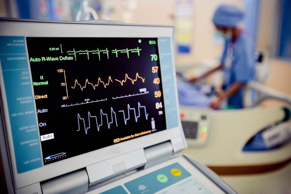Ekg