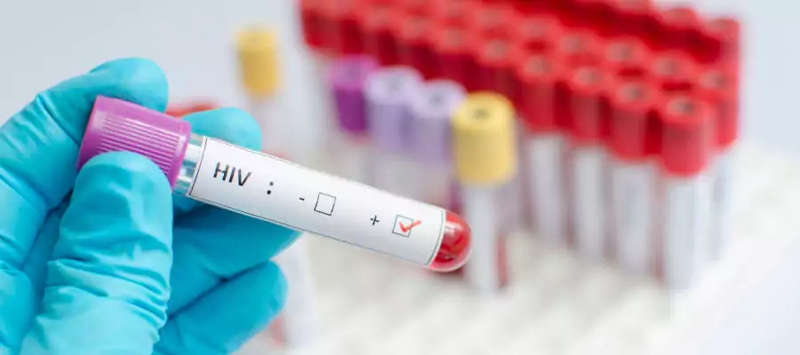 Hiv Testi