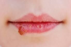 Images (1)-56